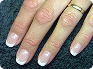 Kunstnagels